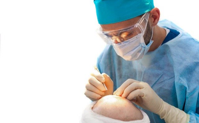 Most Advance Hair Transplant Clinic